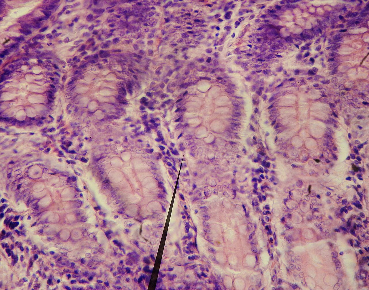 Small intestine