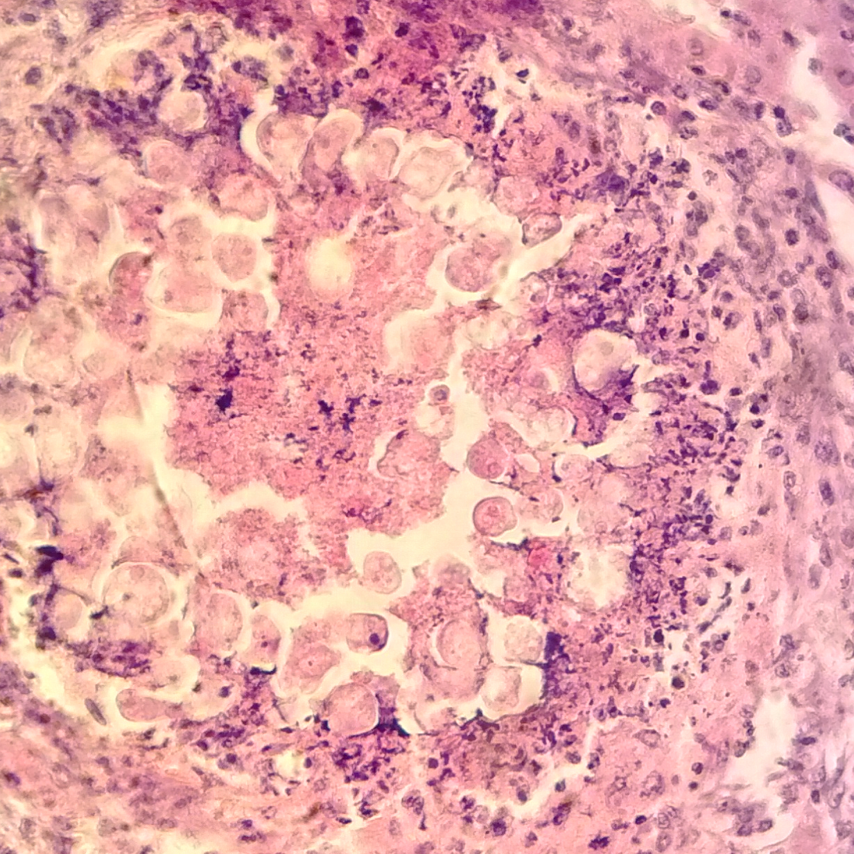 Small intestine