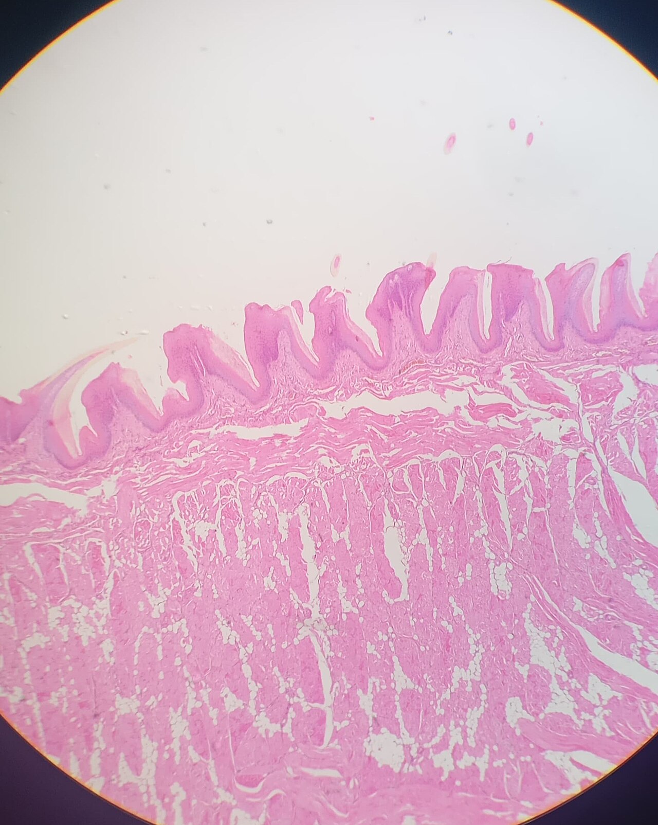 Small intestine
