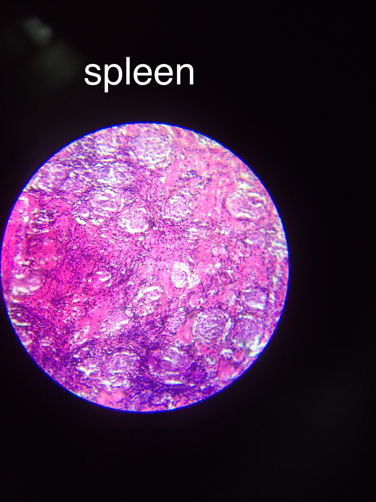 Spleen