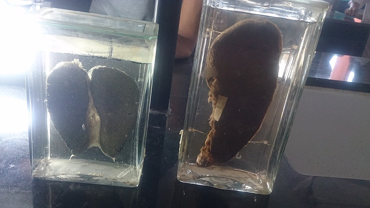 Spleen