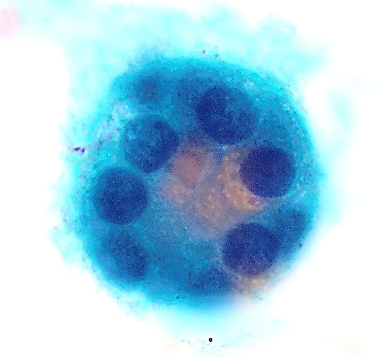 Thyroid