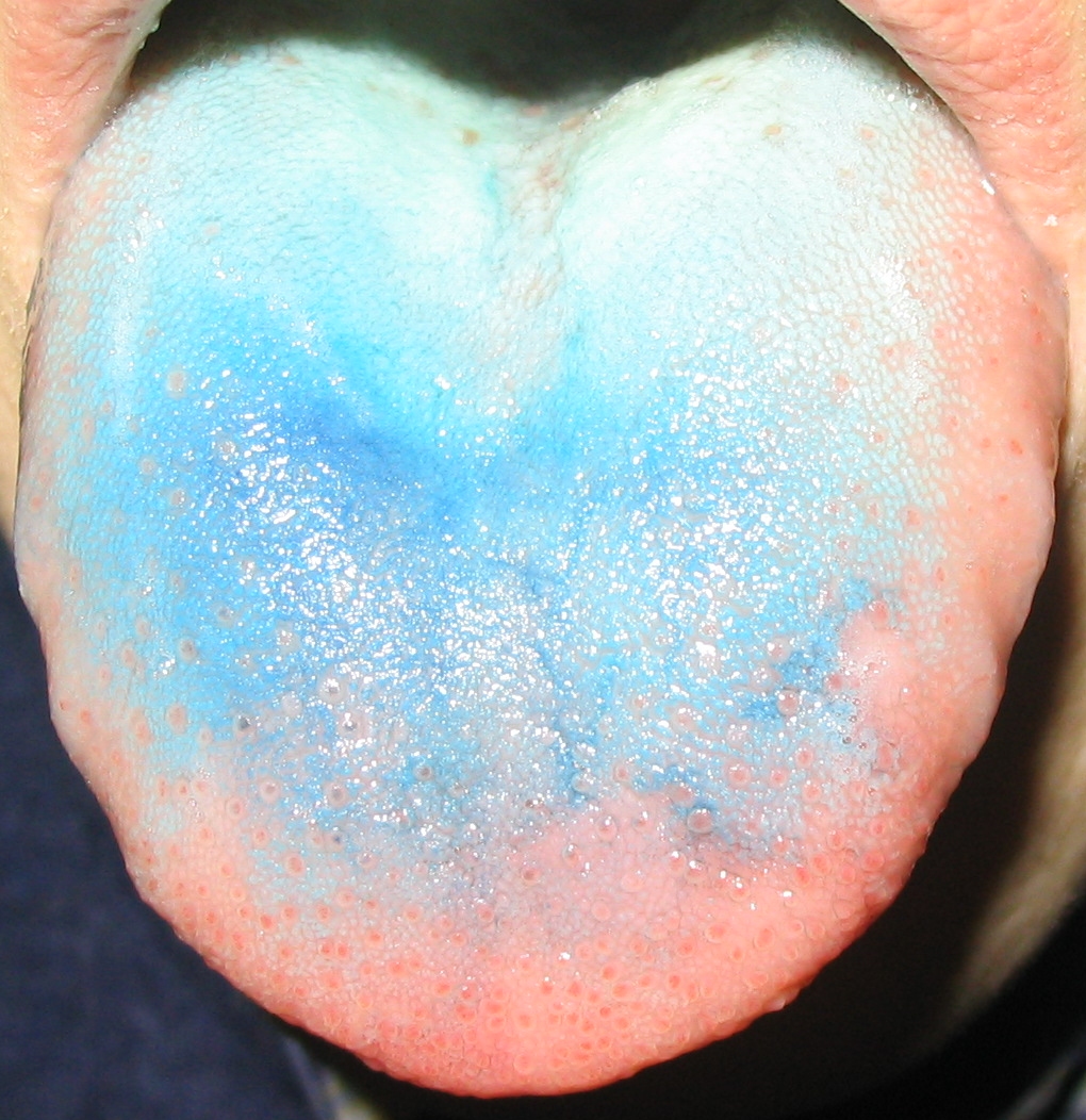 Tongue